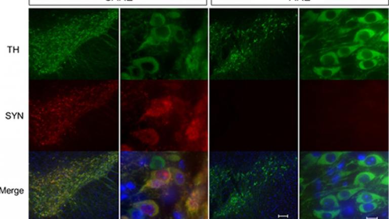 image for article on Research on Alzheimer's Disease