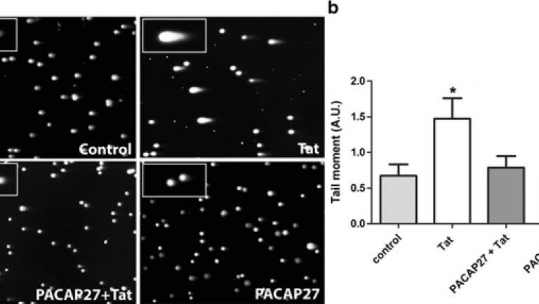 Research on HIV-Associated Neurocognitive Disorders