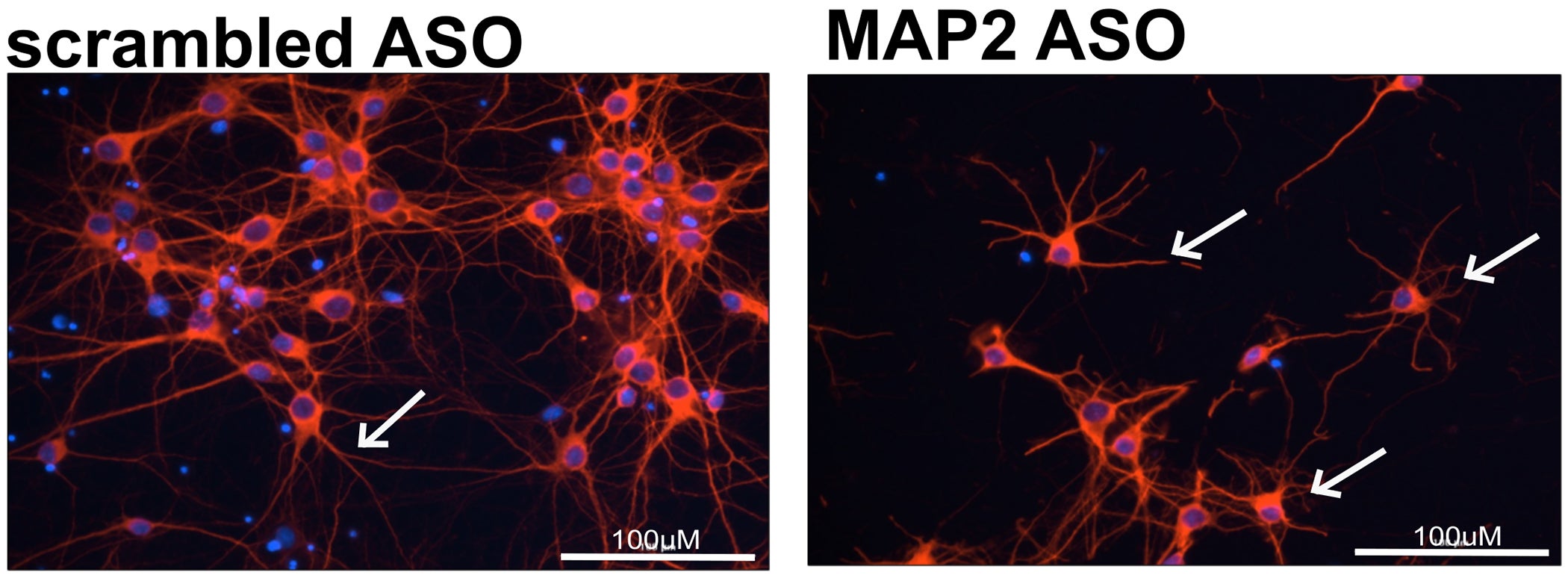 Role of MAP2 in maintenance of neurites.